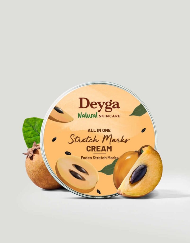 Stretch Marks Cream